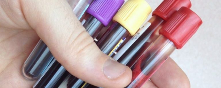 Así funciona un test serológico para el coronavirus