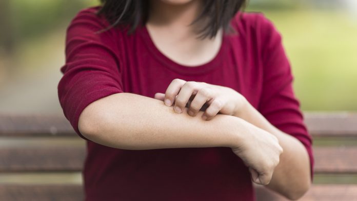 ¿Cómo saber si somos alérgicos a los antibióticos?