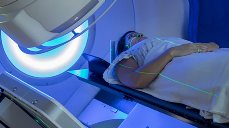 Inteligencia artificial para la planificación de la radioterapia